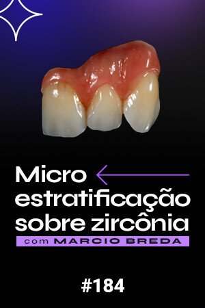 Micro Estratificação sobre Zircônia