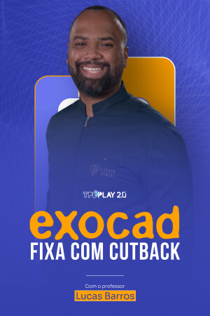 Exocad - Fixa com Cutback