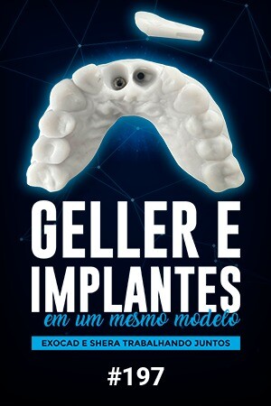 Geller e Implantes em um Mesmo Modelo