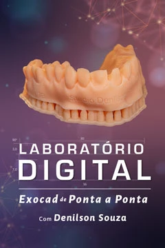 Laboratório Digital - Exocad de Ponta a Ponta