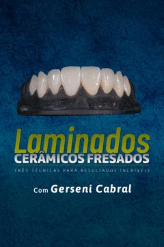 Laminados Cerâmicos Fresados