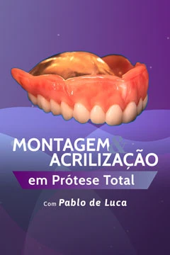 Montagem & Acrilização em Prótese Total